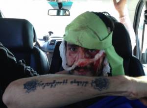 Founding Parliament members severely beaten up: Zhirayr Sefilyan transferred to hospital 