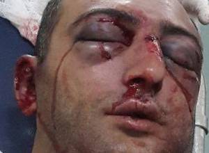 Հարձակվել են Քիմ Քարդաշյանի անվտանգությունը պահպանած «Պանտեռայի» աշխատակցի վրա news.am