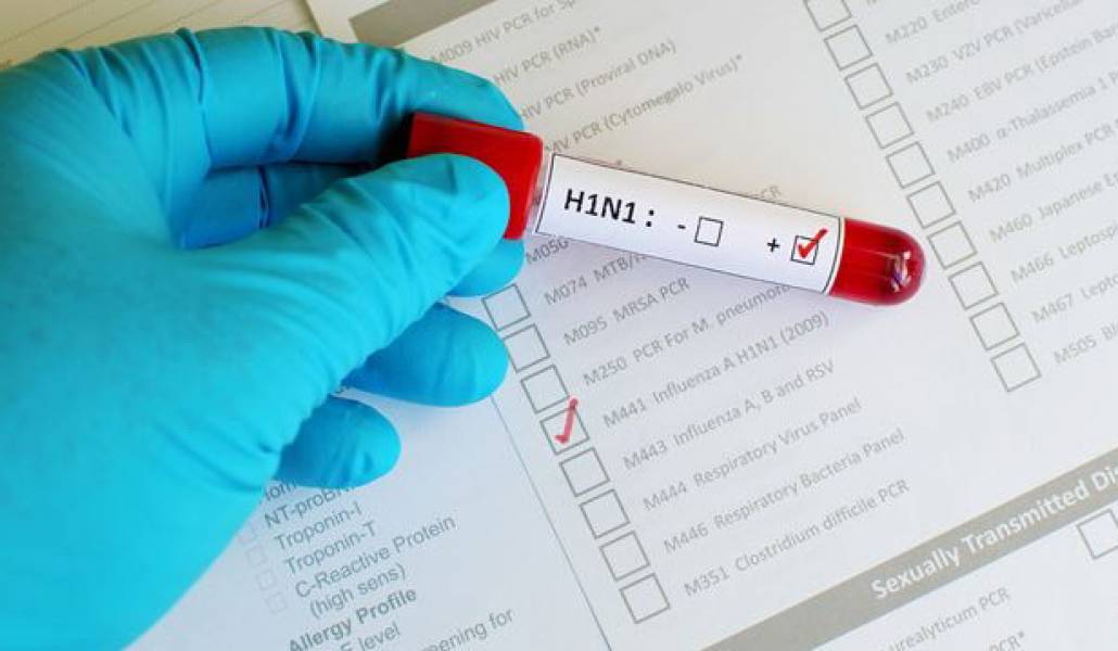 H1N11