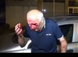 Blood was flowing down my forehead into my eyes -Movses Shahverdyan
