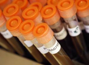 13-летним девочкам сделают прививки против папилломы