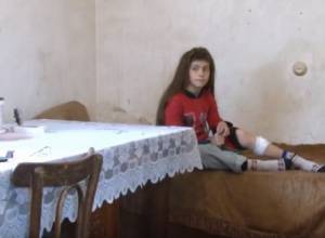 The dog blows a girl's leg, the doctor advises just to wait