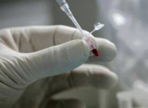 В Армении умерли двое