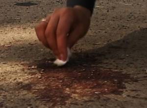 перезал горло