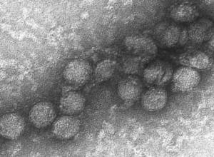 Есть ли в Армении “нильская лихорадка”?