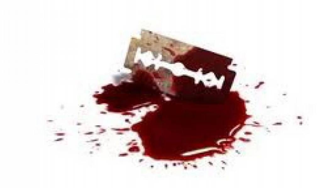 a62f1b077dae4a868c95a0a943ff1e8b