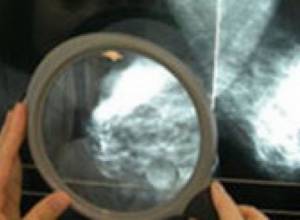 Не надо тратить деньги на лечение рака