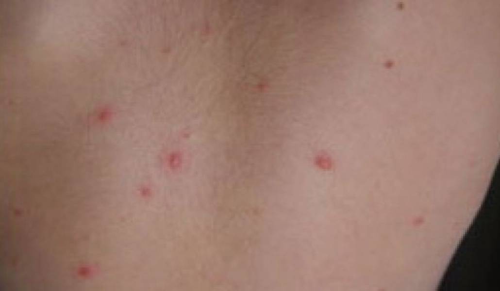 ab75914638b89cdb0973c3caee18cdbf