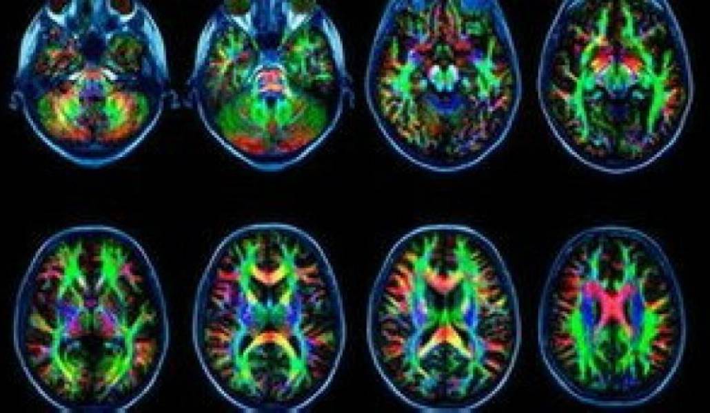 6f8075750d9bfdf2802b427a897882e7