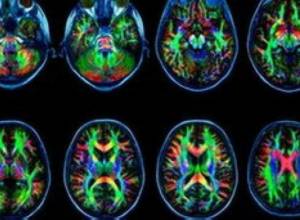 Интернет меняет структуру нейронов