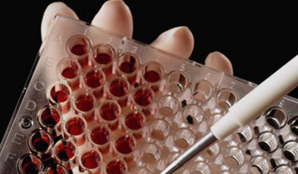 2fcd74a4f5f6c3489905a2c9f6c9a54d