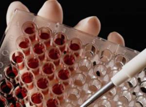 Известия о сибирской язве преувеличены?