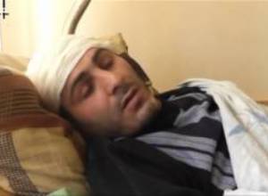 Ինչպես են ծեծել ՀԱԿ անդամին