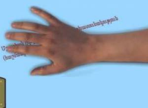 ԴԺԲԱԽՏ  ՊԱՏԱՀԱՐՆԵՐԻՑ  ԱՊԱՀՈՎԱԳՐՈՒԹՅՈՒՆ