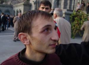 Tigran Arakelian stops hunger strike