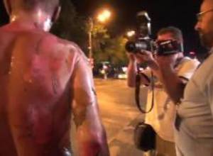 Ինքնահրկիզման փորձ կատարած քաղաքացուն տեղափոխեցին հիվանդանոց