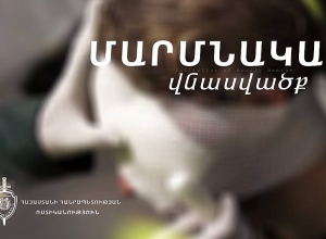 Ատրճանակի կոթով հարվածել են երիտասարդի գլխին