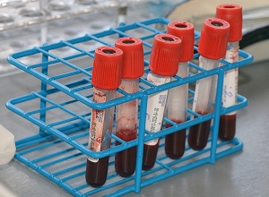 Անասնաբույժը 1 կենդանու արյունը բրուցելոզի ախտորոշման է  ներկայացրել 91-ի փոխարեն