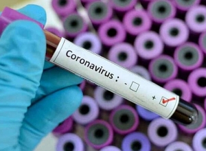 12 people hospitalized in Turkey on suspicion of coronavirus