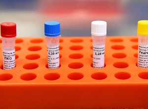 Что такое коронавирус и как от него защититься?