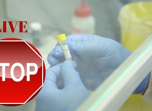 Նոր կորոնավիրուսով պայմանավորված իրավիճակը, կանխարգելիչ միջոցառումները․ Ուղիղ