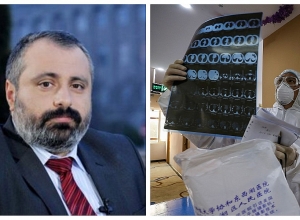 Нет причин для отмены выборов в Арцахе: Давид Бабаян