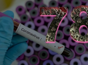 По положению на данный момент подтверждено 78 случаев: Арсен Торосян