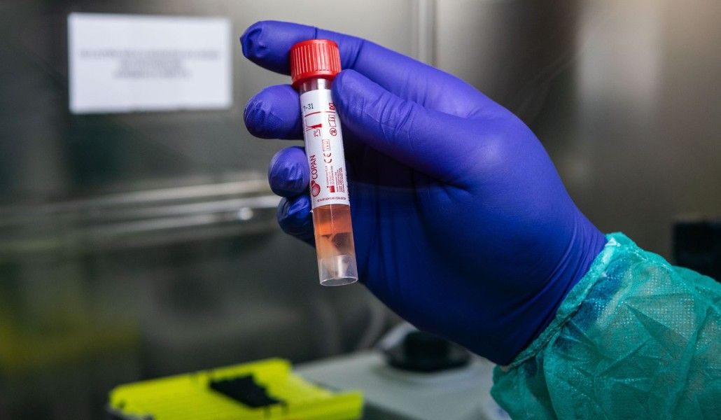 կորոնավիրուս