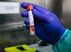 Current confirmed cases of coronavirus