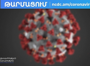 2 out of 13 pneumonia patients are in extremely severe condition -  speaker