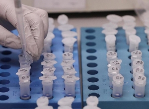 One more coronavirus patient has recovered - Healthcare Minister