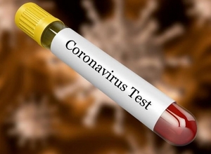 Resident of Karvachar infected with coronavirus tested negative