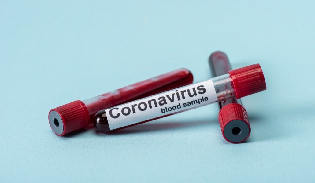 koronavirus