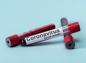 COVID-19, справка об открытом счете