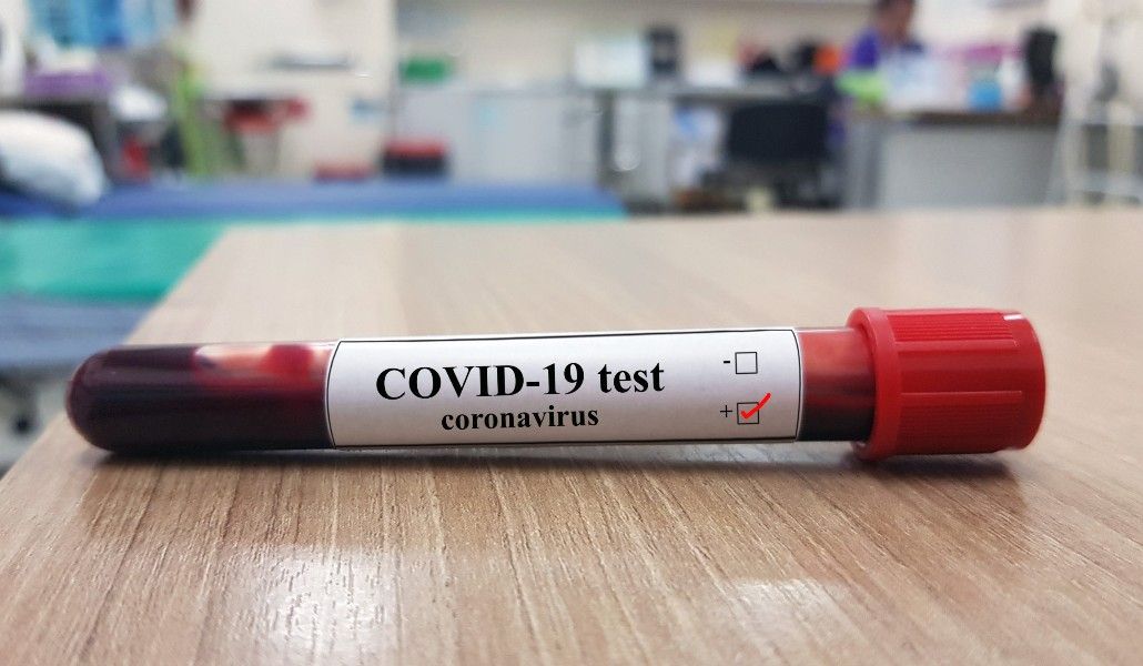 կորոնավիրուս