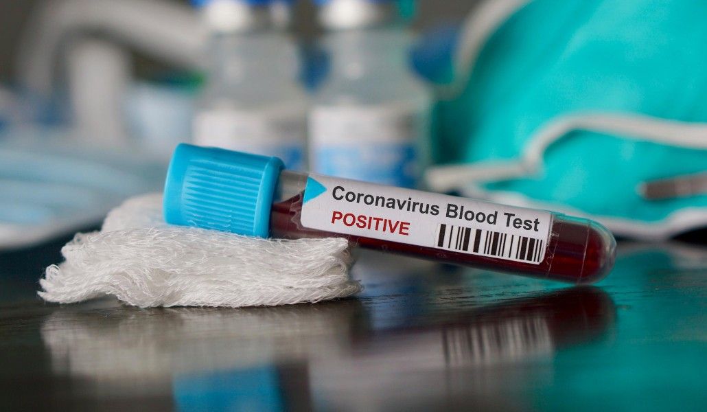 կորոնավիրուս1