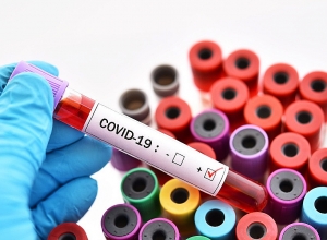 3 случая коронавируса в Арцахе