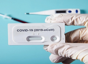 Կառավարությունն ի՞նչ գնով է ձեռք բերել կորոնավիրուսը հայտնաբերող PCR թեստերը կամ շնչառական ապարատները