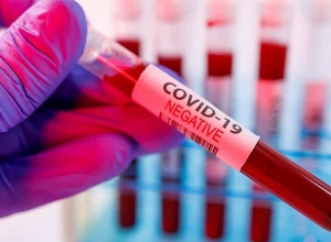 Результаты тестов на коронавирус членов клуба “Ноа” были отрицательными