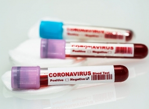 Еще один из заразившихся в Арцахе выздоровел, сегодня его выпишут