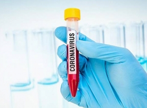 В Арцахе подтверждено 6 новых случаев заражения коронавирусом