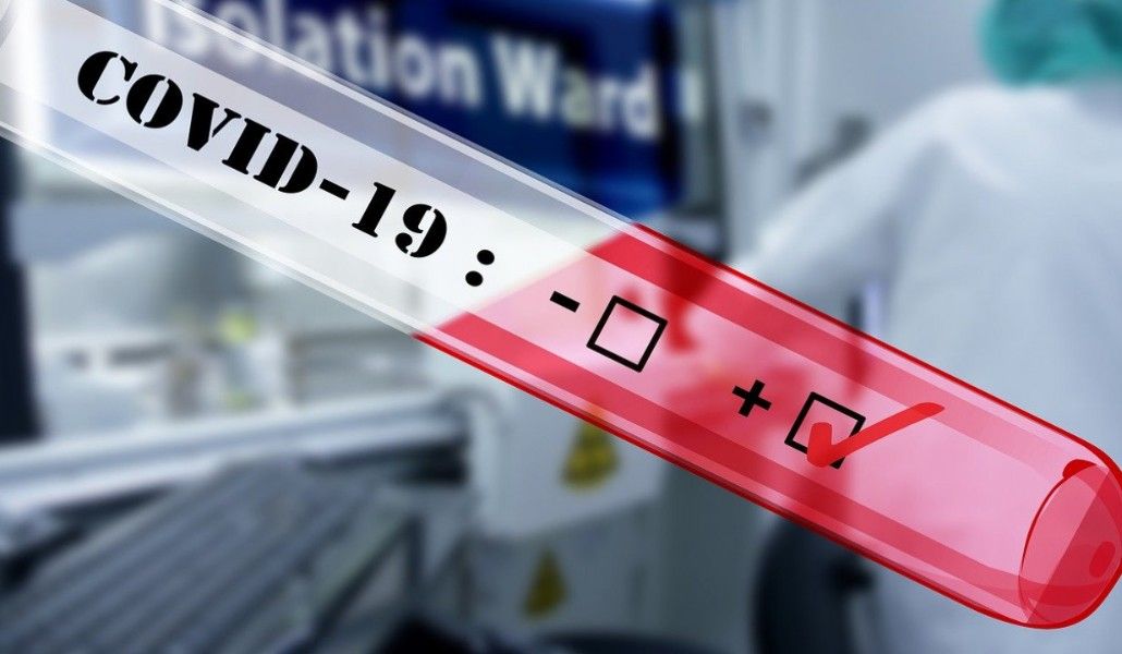 2020053101214323067_v-kyrgyzstane-za-sutki-obnaruzhili-42