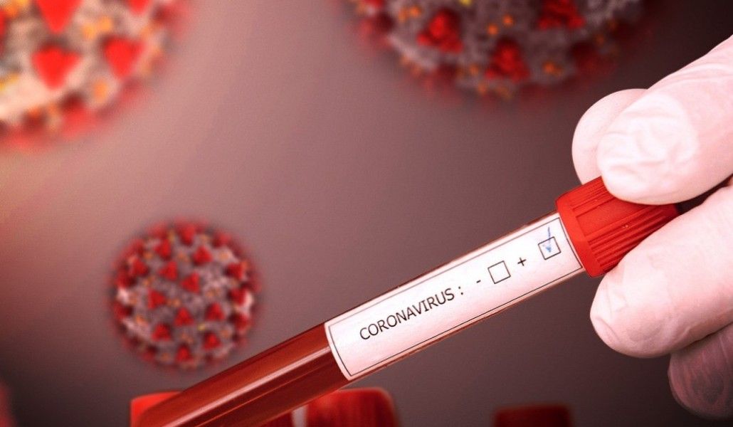 կորոնավիրուս 2