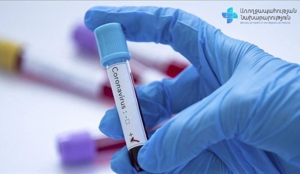 կորոնավիրուս