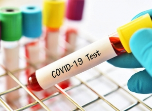 8 человек скончались от коронавируса за сутки