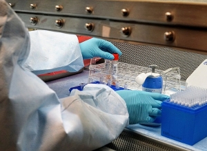 Коронавирус в Армении: за сутки подтверждено 337 случаев заражения 4 летальных исхода