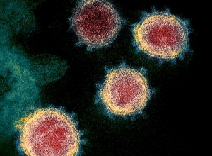 2 новых случая смерти – одна женщина, один мужчина