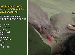 Омбудсмен опубликовал видеоматериал: Первая помощь – потеря сознания