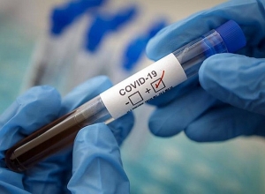 В Армении впервые зафиксирована смерть ребенка от коронавируса: у него были тяжелые сопровождающие заболевания