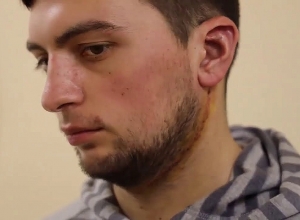 Բժիշկների համատեղ ջանքերի շնորհիվ կվերադառնա զինվորի ժպիտը